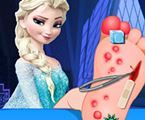 choi game Phẫu thuật chân cho Elsa