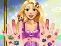 choi game Rapunzel hand treatment